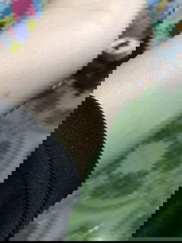 เข็มยาคุมแบบ5ปี