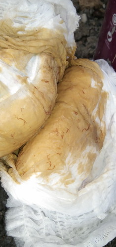 Bab anak cair dan berbau busuk dan ada serat serat merah kalau kentut juga berbau sangat menyengatt