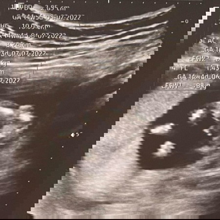 บ้านไหนรู้เพศแล้วบ้างค่ะ🥰 ดูออกกันไหม⁉️