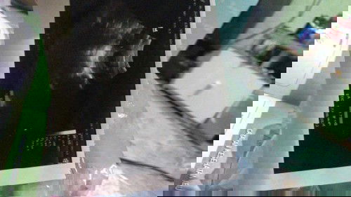 USG 8 week belum terlihat janin nya