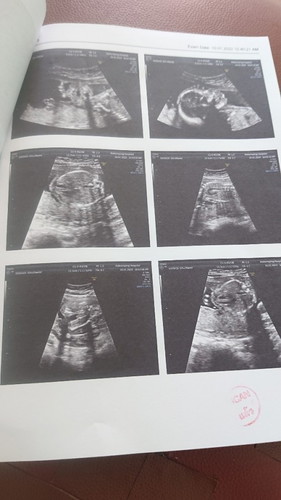 สอบถามน้ำหนักลูกหน่อยค่ะ