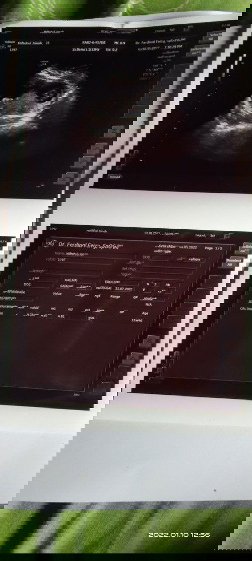 Coba sharing untuk yg pernah punya bayi kembar