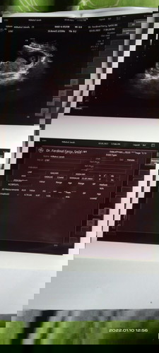 Coba sharing untuk yg pernah punya bayi kembar