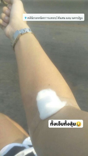 ความเจ็บที่สวยงาม