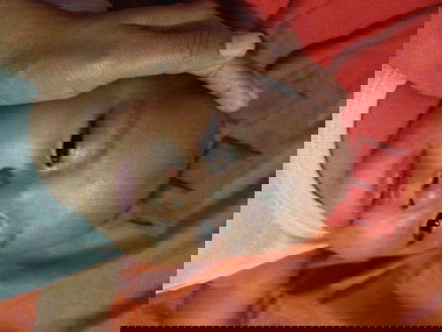 Putih diwajah seperti panu pada bayi