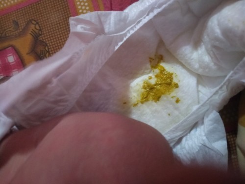 สอบถามนะค่ะลูก4วันอึออกมาสีเเบบนี้ปกติไหมเป็นน้ำกังวลมากค่ะ