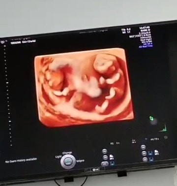 อวดภาพน้องกันหน่อยค่ะแม่😅