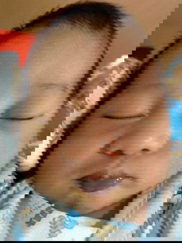 ลูกปากดำเกิดจากอะไร