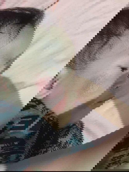 HELLLLP NAMAN PO SA SKIN ASTHMA AND ATOPIC