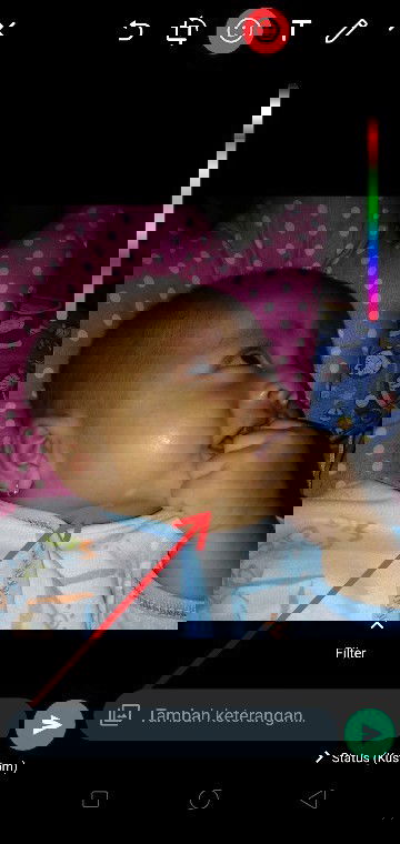 Bintik putih minta solusinya dong bun