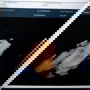 Alhamdulillah Baby Boy 💙