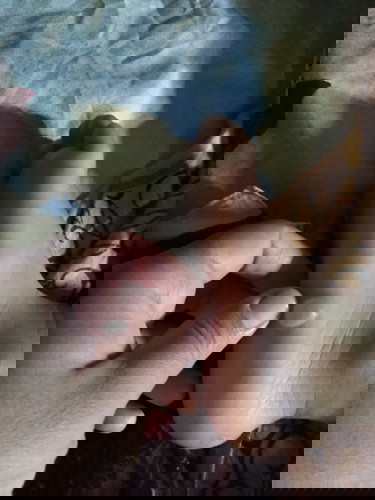 Bun,ini kenapa ya?Adakah anak nya yg pernah mengalami hal yg sma?udah periksa 2 kali,tapi ga sembuh"