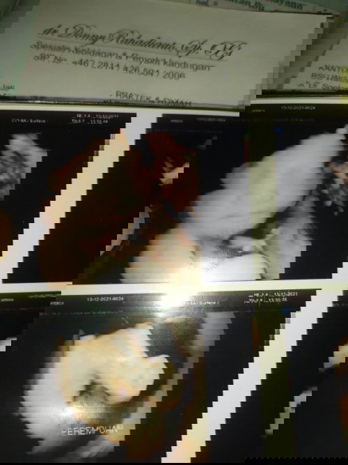 Posisi kepala muter lagi