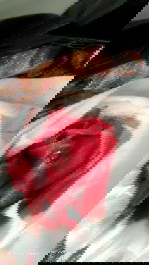 Apa itu janin tidak berkembang