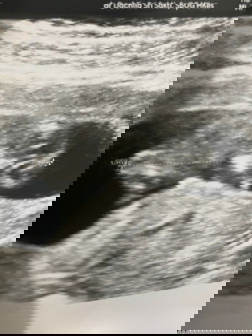 12 Weeks - masih mual muntah