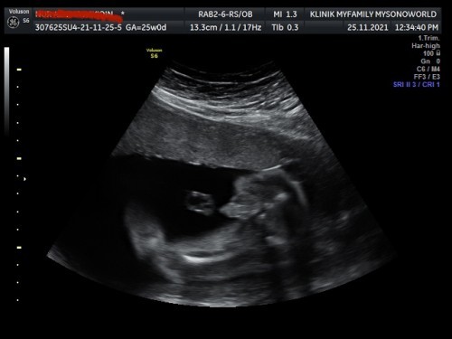 Baby girl @ baby boy ya?