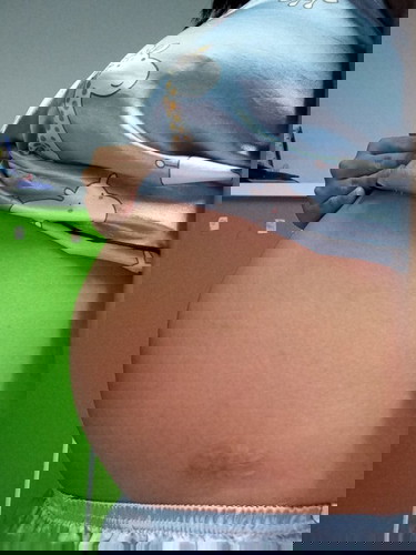 อาการปวดซี่โครง