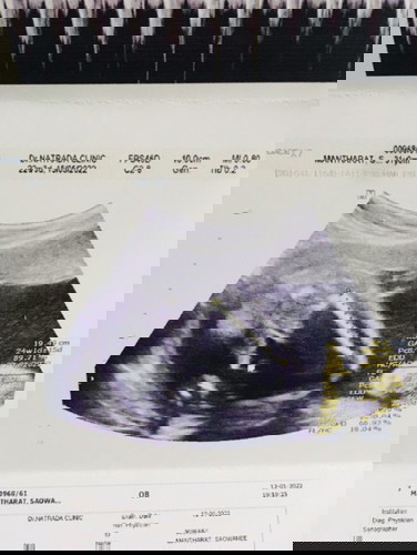 เรื่องเพศลูกท้อง2อยากได้ลูกสาวค่ะ