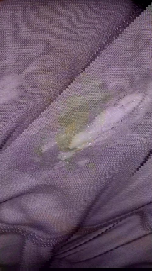 Bund ada yg pernah begini ga?