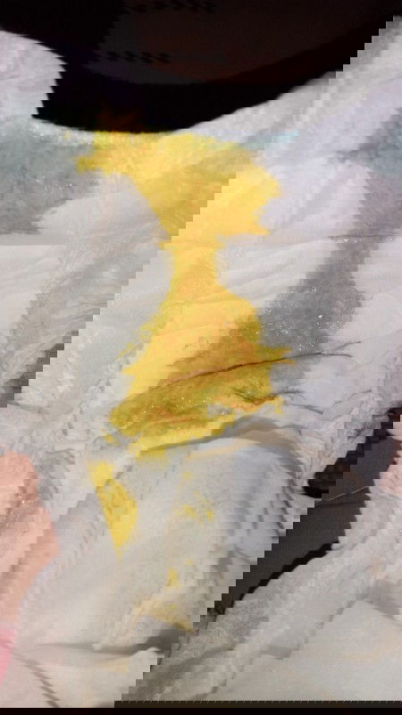 ถ่ายออมาสีแบบนี้ปกติไหมค่ะ