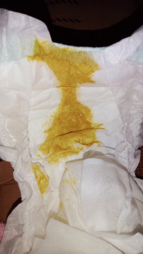 ถ่ายออมาสีแบบนี้ปกติไหมค่ะ