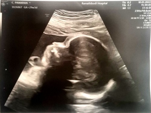 ลูกสาวแม่♥️