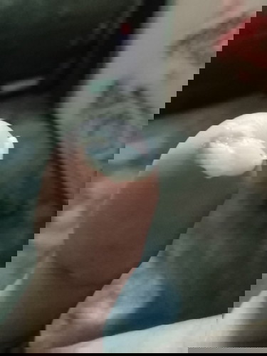 ตกขาว หรือ มูก