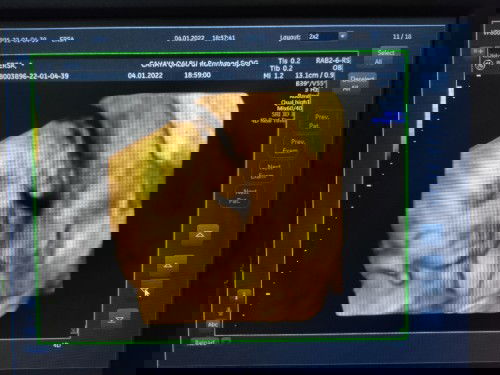 Berat badan janin usia kandungan 29 minggu