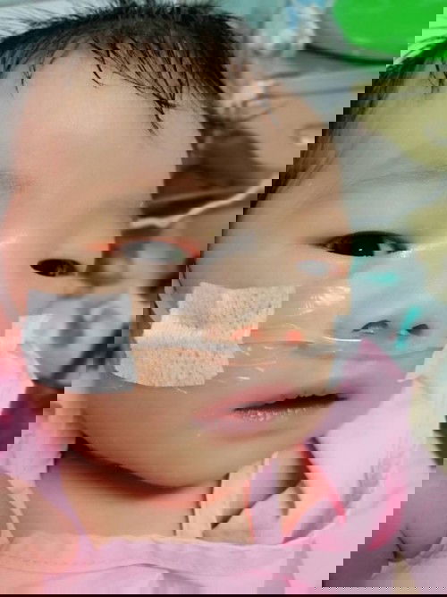 ความดันในปอด