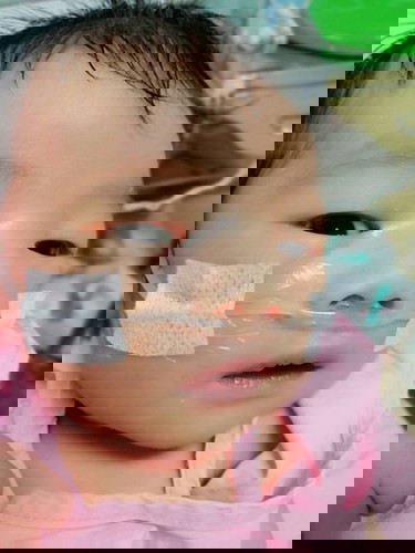 ความดันในปอด