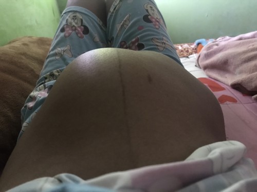 อายุครรภ์ 36 5 w