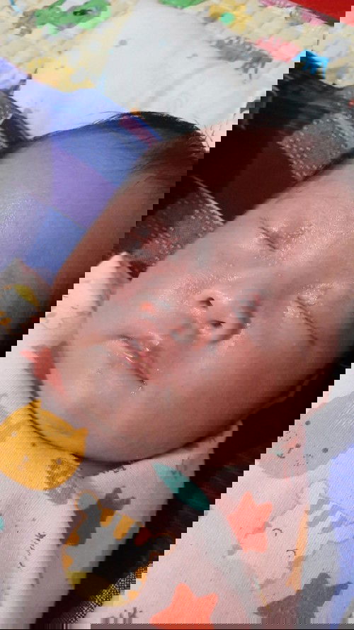 Bintik merah pada wajah bayi