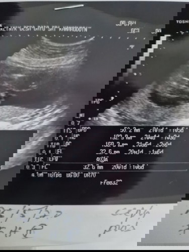 Gambar scan gender