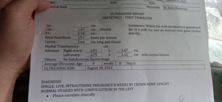 152bpm heartbeat per minute tapos nasa LEFT OVARIES kopo sya BABY GIRL or BABY BOY? thank you po