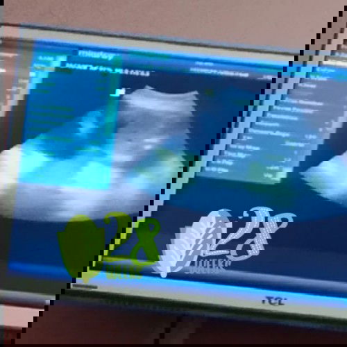 Kaki itu mungil"😘