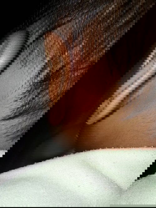 Tanya belakang telinga merah