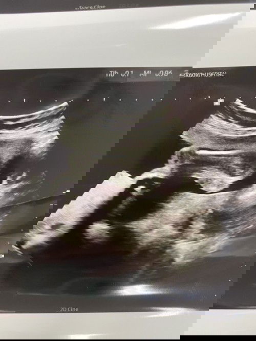 ช่วยดูหน่อยจ้า 
ทีมมีนาคม65