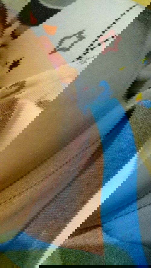 Cara menghilangkan biang keringat