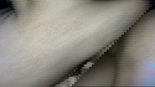 Solusi untuk kulit kering bayi