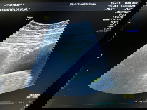 First Time Mom Journey Begin