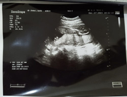 Uk17w5d masih blm mau susu hamil