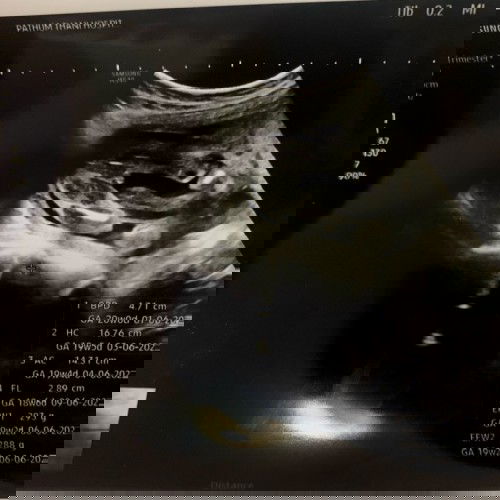 สอบถามแม่ๆคะ