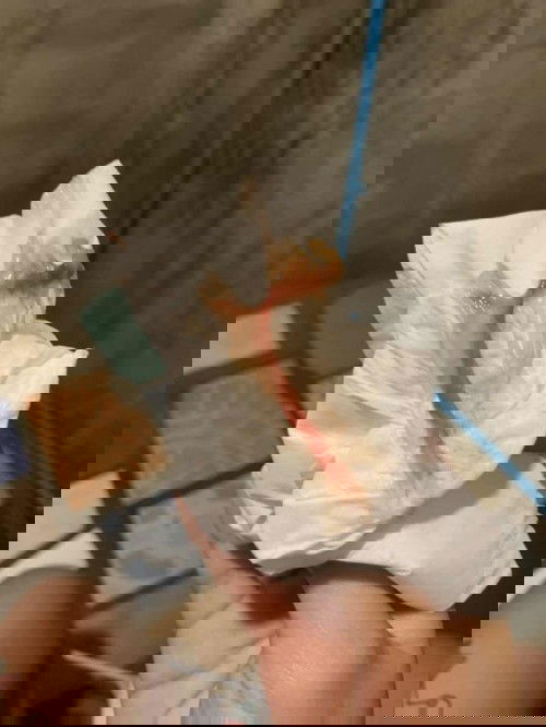 มีมูกเลือดแบบนี้ควรไปหาหมอเลยไหมคะ