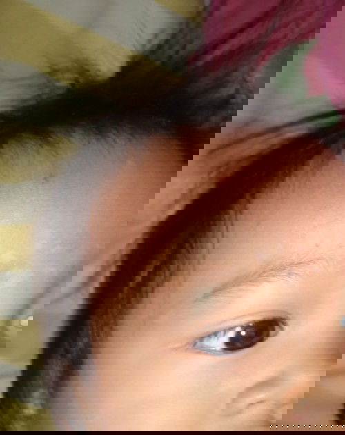 Putih-putih seperti pada pada wajah bayi, tidak gatal