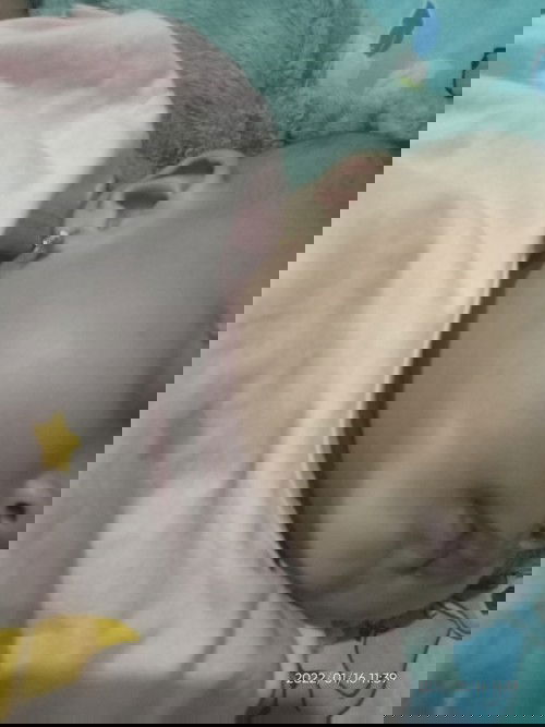 Bercak putih dibwajah