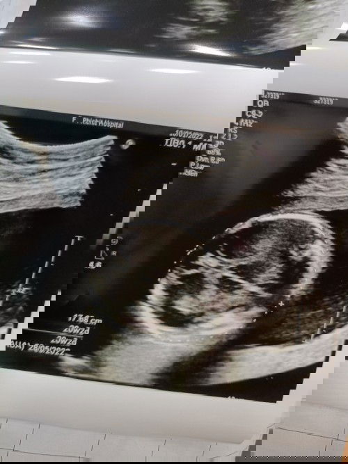 แม่ๆช่วยดูหน่อยจ้า