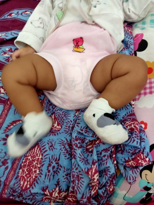 Struktur kaki bayi