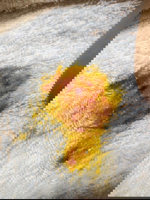 อยากถามคุณแม่แต่ละท่านคะ ลูกถ่ายแบบนี้เป็นไหมคะ อันตรายไหมเป็นเหมือกเลือดเป็นเส้นๆคะแต่ก็ปกติไม่งอแง