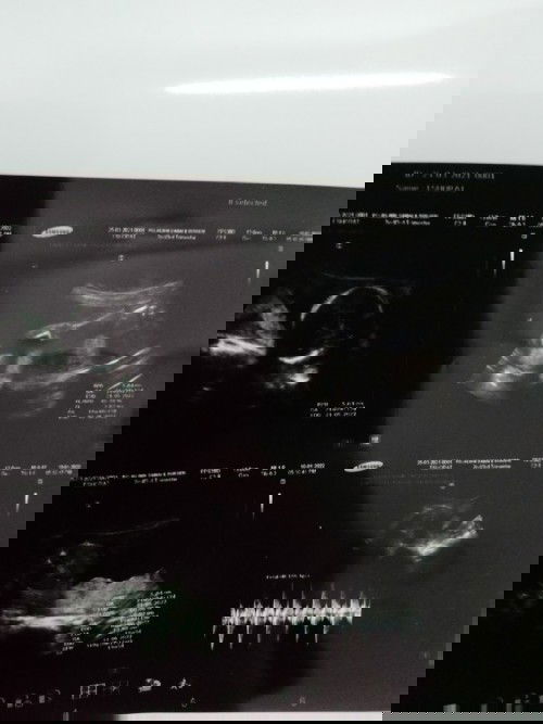 Nak tahu boys or girl