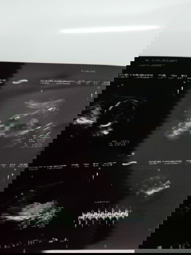 Nak tahu boys or girl